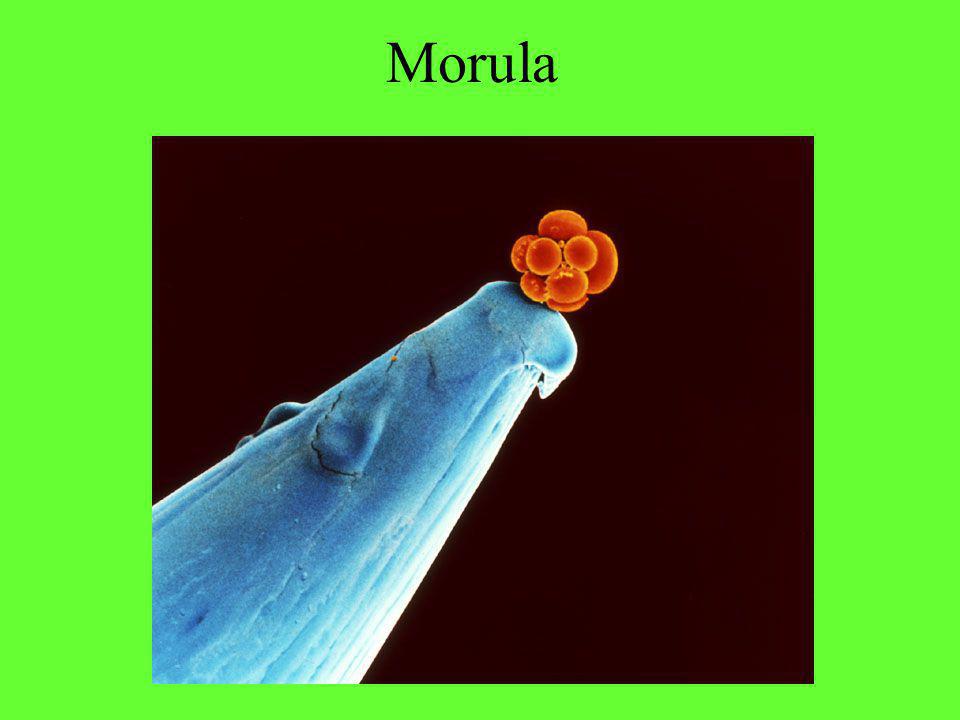 Morula Morula op de punt van een naald