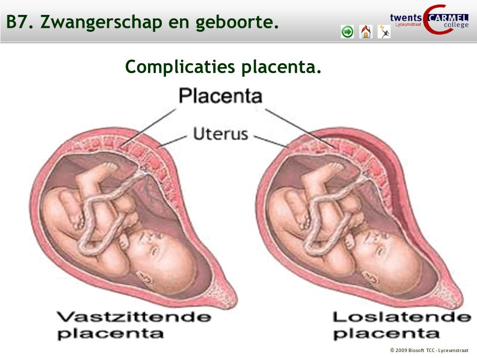 B7. Zwangerschap en geboorte.