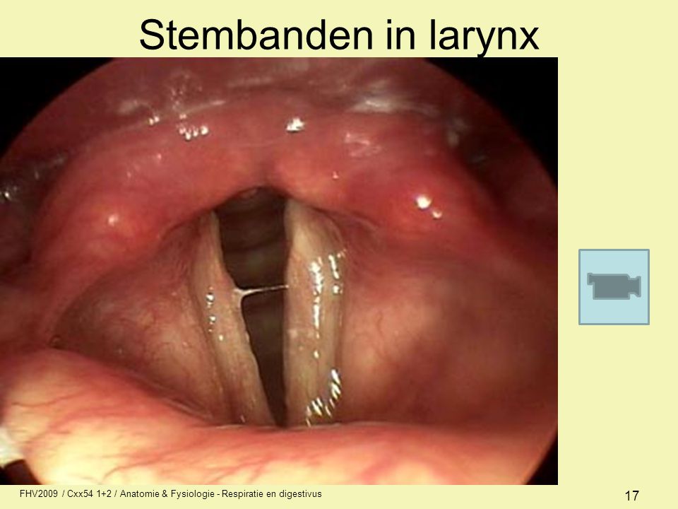 Stembanden in larynx FHV2009 / Cxx / Anatomie & Fysiologie - Respiratie en digestivus