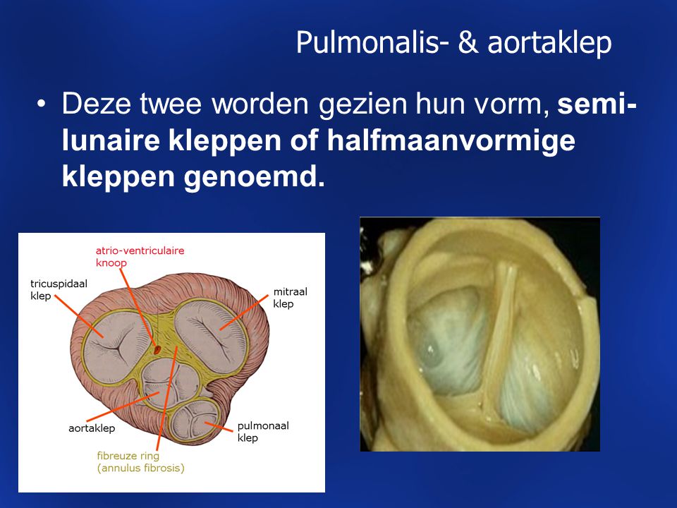 Pulmonalis- & aortaklep