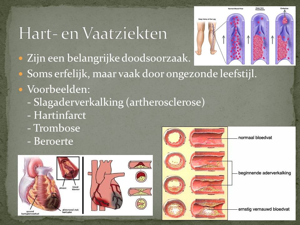 Hart- en Vaatziekten Zijn een belangrijke doodsoorzaak.