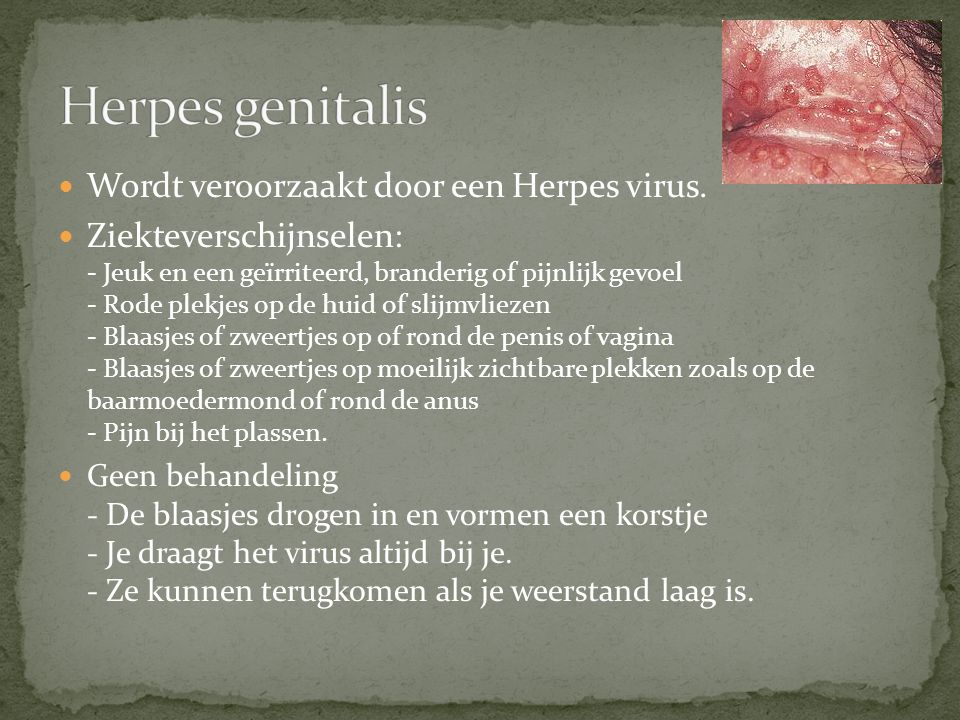 Herpes genitalis Wordt veroorzaakt door een Herpes virus.