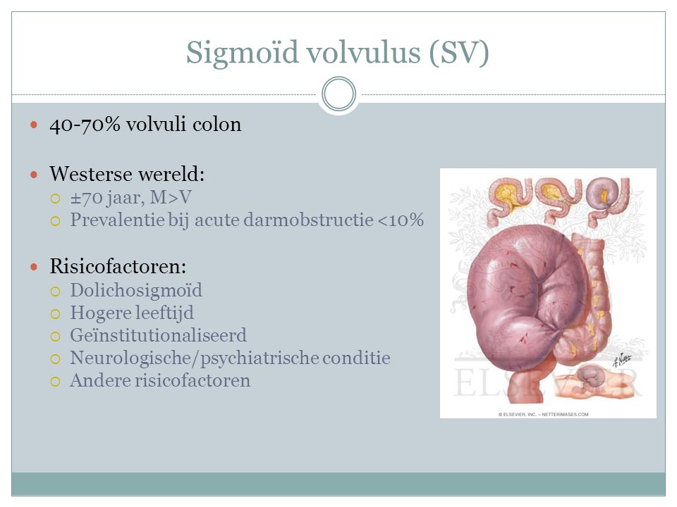 Sigmoïd volvulus (SV) 40-70% volvuli colon Westerse wereld: