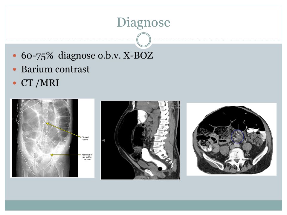 Diagnose 60-75% diagnose o.b.v. X-BOZ Barium contrast CT /MRI
