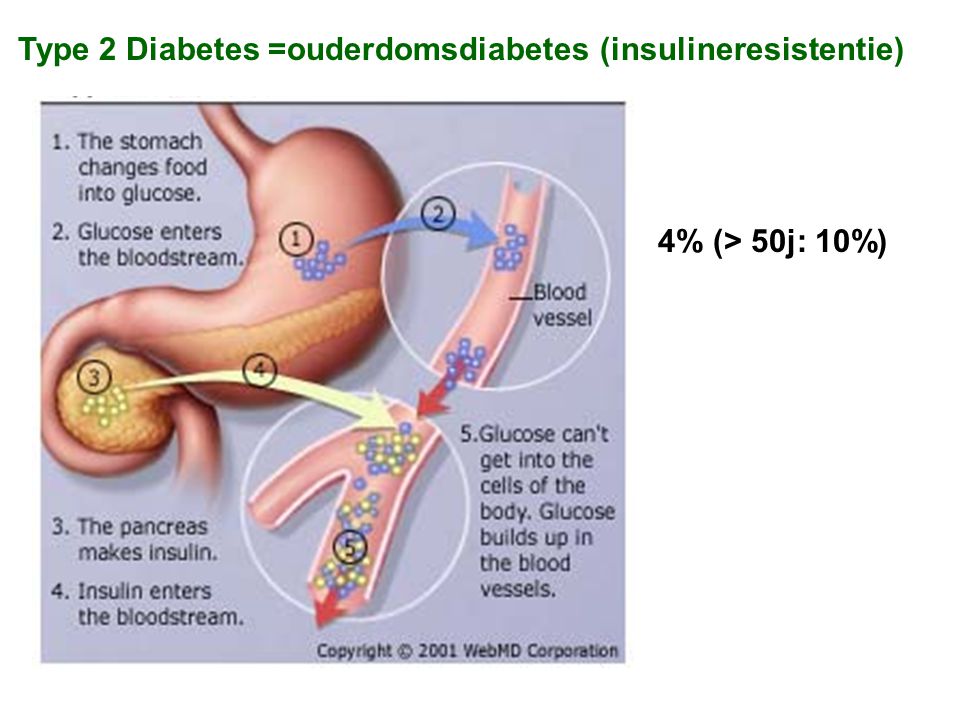 Type 2 Diabetes =ouderdomsdiabetes (insulineresistentie)