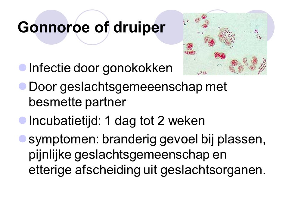 Gonnoroe of druiper Infectie door gonokokken