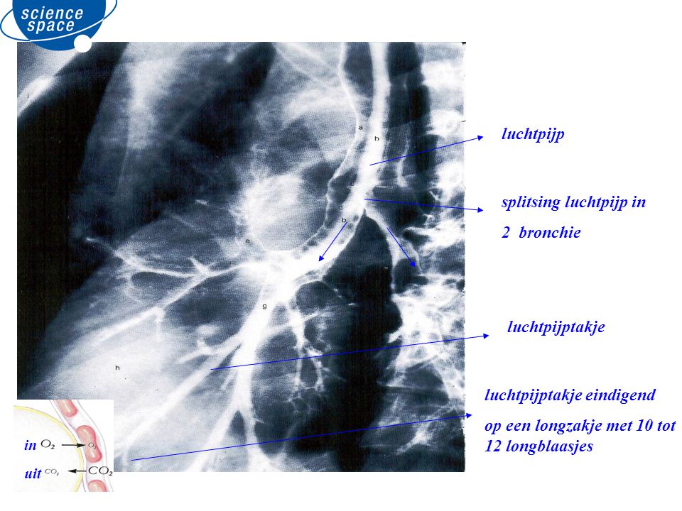 splitsing luchtpijp in 2 bronchie