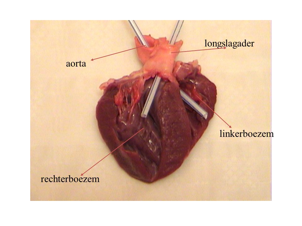 longslagader aorta linkerboezem rechterboezem