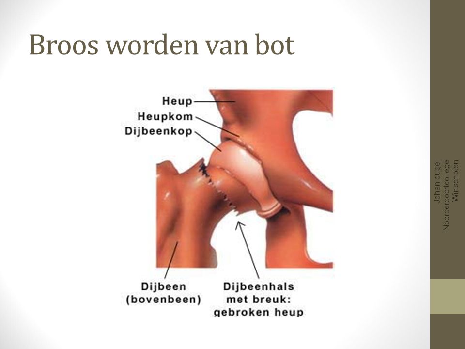 Broos worden van bot Johan bugel Noorderpoortcollege Winschoten