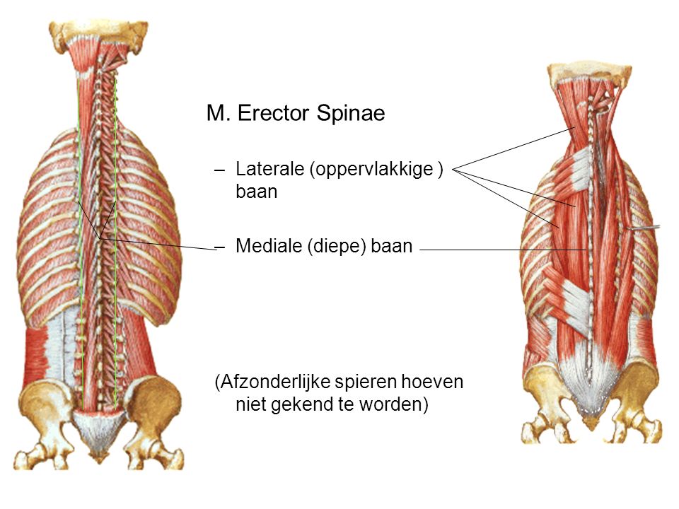M. Erector Spinae Laterale (oppervlakkige ) baan Mediale (diepe) baan