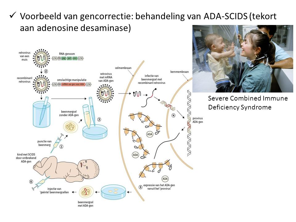 Voorbeeld van gencorrectie: behandeling van ADA-SCIDS (tekort aan adenosine desaminase)
