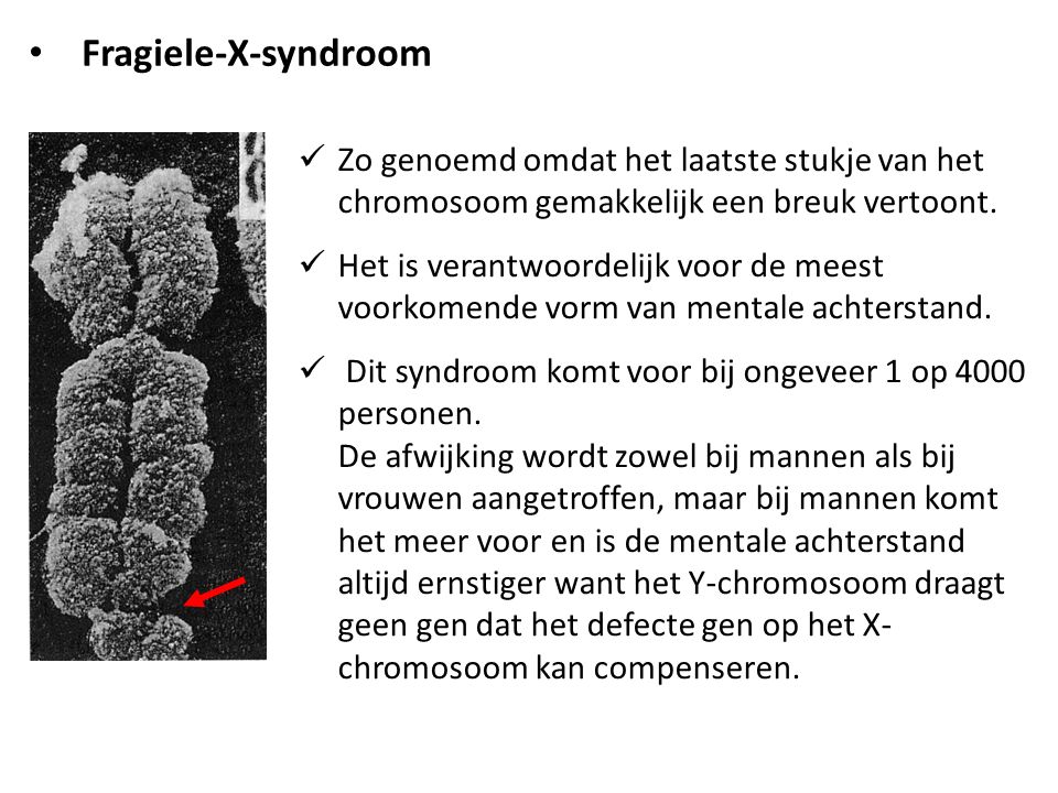 Fragiele-X-syndroom Zo genoemd omdat het laatste stukje van het chromosoom gemakkelijk een breuk vertoont.