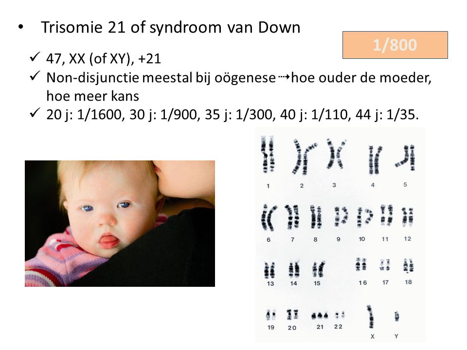 Trisomie 21 of syndroom van Down 1/800